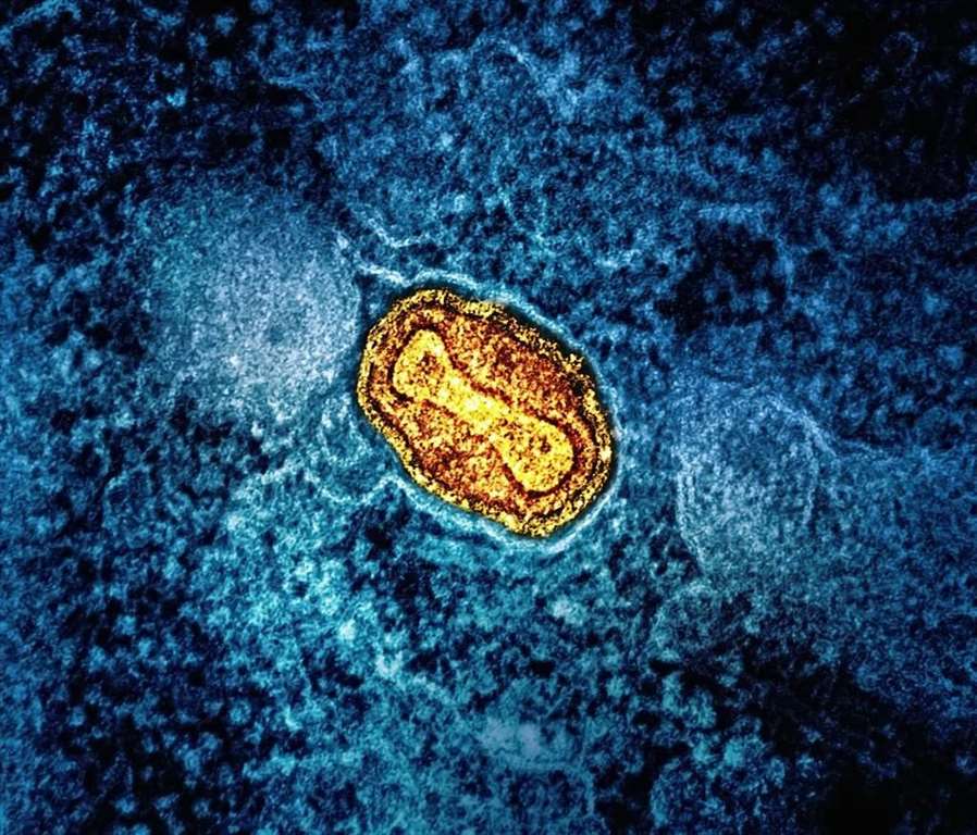 Συναγερμός για την εξάπλωση του ιού Mpox στην Ευρώπη – Πώς μεταδίδεται και ποιοι κινδυνεύουν